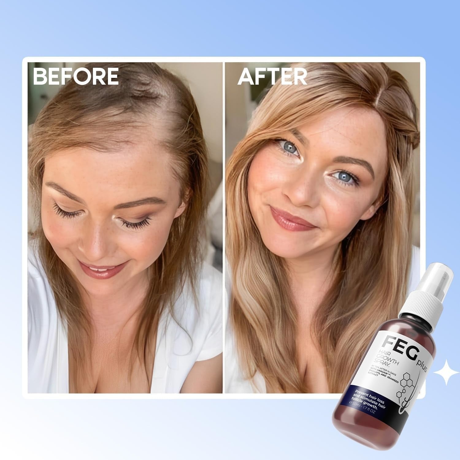 FEGPlus Minoxidil Serum
